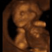 3D Baby Pictures 5