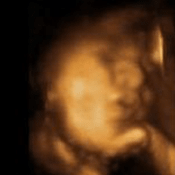 3D Baby Pictures 3