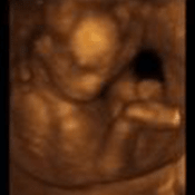 3D Baby Pictures 4