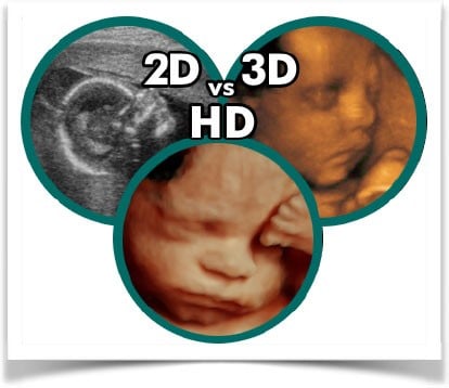 2D Vs. 3D Vs. HD images