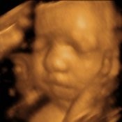 3D Baby Picture 6